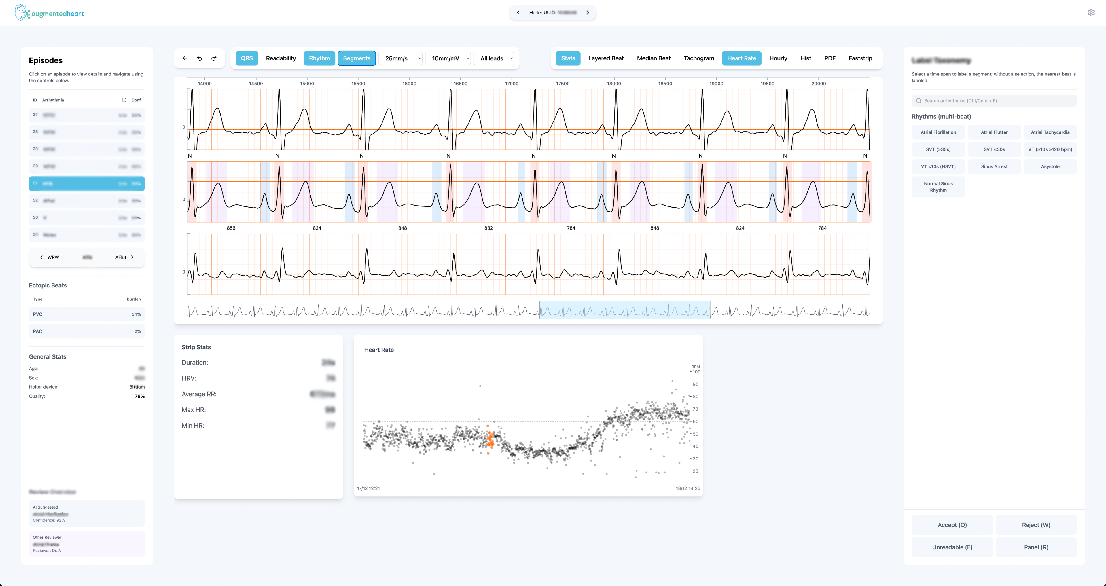 AugmentedHeart Dashboard