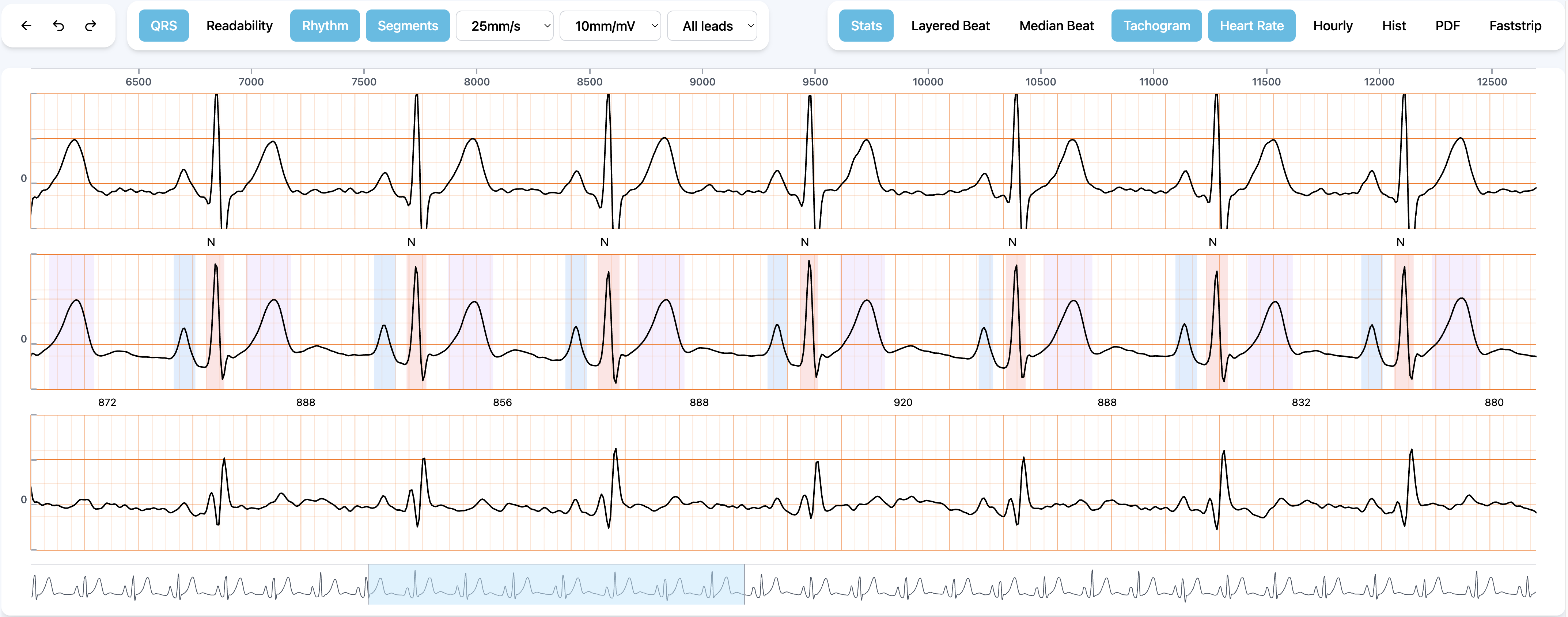 AugmentedHeart Dashboard